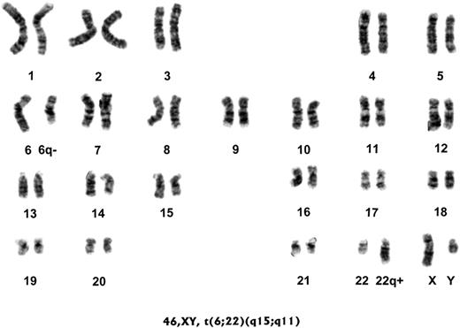 Figure 4. Abnormal karyotype of human PBMCs immortalized by infection of M fermentans. Human PBMCs (K4413-Mi) from a healthy donor with a normal karyotype were infected with M fermentans incognitus strain for 5 months. The immortalized human PBMCs were subjected to the karyotyping study. Results show that more than 95% of the immortalized K4413-Mi cells had a reciprocal translocation between chromosomes 6 and 22.