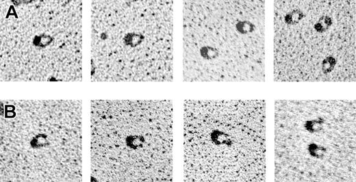 Figure 3. Transmission electron microscopy of purified αIIbβ3 in the presence of 1 mM Ca2+ or 1 mM Mn2+. Individual αIIbβ3 molecules were visualized using transmission electron microscopy after rotary shadowing with tungsten. The images could by classified into 3 groups, of which 2 are shown. (A) Closed structures with the tips of the αIIb and β3 stalks touching that were obtained in the presence of 1 mM Ca2+. (B) Open structures with the αIIb and β3 stalks separated that were obtained in the presence of 1 mM Mn2+. A minority of structures consisting of globular headpieces with no visible stalks were also observed in the presences of both Ca2+ and Mn2+. Magnification, × 170 000.