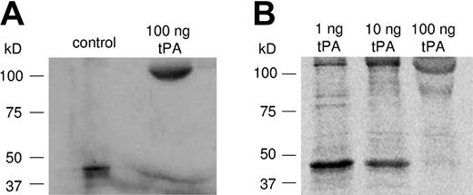 Figure 4. Functional analysis of the activity of newly synthesized PAI-1. Platelets were incubated in the presence of 1, 10, and 100 ng tPA for 6 hours as described in Figure 3. (A) Addition of 100 ng tPA resulted in a different migration position corresponding to the expected position of the tPA/PAI-1 complex, indicating that newly synthesized PAI-1 is active. (B) Addition of increasing concentrations of tPA reduced the free PAI-1 protein and increased the tPA/PAI-1 complex.