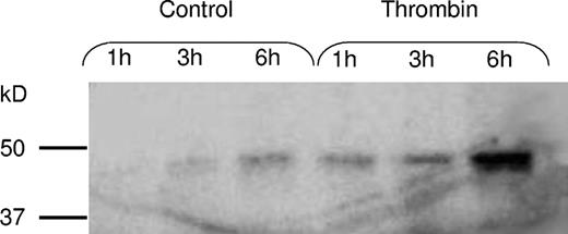Figure 5. Stimulation of PAI-1 synthesis with thrombin. To investigate whether the platelets could be stimulated to increase the synthesis rate, platelets were incubated for 1, 3, and 6 hours, as described in Figure 3, in the absence or presence of 0.1 U/mL thrombin. Thrombin activation was found to increase the rate of PAI-1 synthesis.