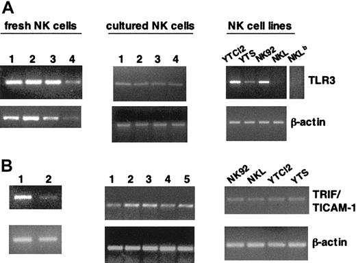 Figure 1. Human NK cells and NK cell lines express TLR3 and TRIF/TICAM-1 mRNA. Total RNA from highly purified fresh (both panels, left) and short-term cultured (A-B, middle) NK cells from different donors and a panel of NK cell lines (both panels, right) was subjected to RT-PCR with specific primers for TLR3 (A) and TRIF/TICAM-1 (B); β-actin amplification, as control, is shown in the lower lanes. A longer exposure for the TLR3 sample in NKL is shown in panel A (NKLb). The data shown are representative of 1 out of 4 independent experiments.