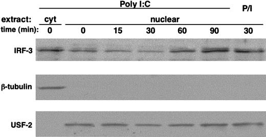 Figure 5. Poly I:C triggers IRF-3 activation in human NK cells. Polyclonal highly purified cultured NK cells (10 × 106 per sample) were stimulated with poly I:C (100 μg/mL) or PMA (50 ng/mL)/ionomycin (0.5 μM) (P/I) at 37°C for the indicated times. Cytosolic and nuclear extracts were separated on SDS-PAGE and immunoblotted with anti–IRF-3 Ab (top). Subcellular fractionation was checked by blotting with anti–β-tubulin (middle) and anti–USF-2 transcription factor (bottom) Abs. These data are representative of 1 out of 3 independent experiments.