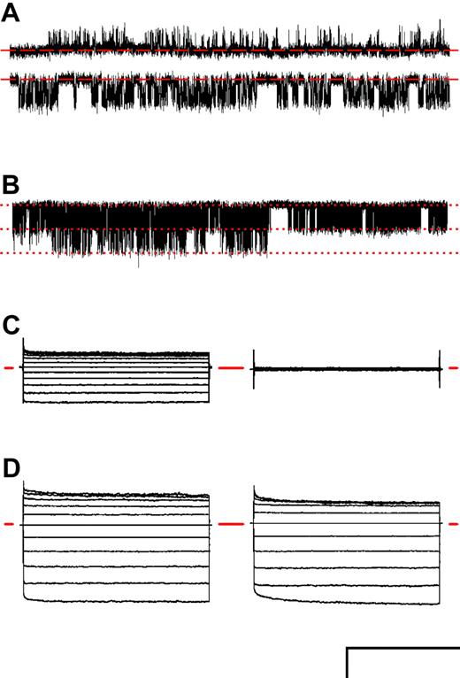 Figure 4. PSAC activity on RBCs from CFTRΔF508/ΔF508 donors. (A) Single-channel recordings on an RBC from a CFTRΔF508/ΔF508 donor infected with a trophozoite-stage parasite. Bath and pipette contained solution A. Vm was +100 or -100 mV (upper and lower traces, respectively). Closed channel levels are indicated by dashed red lines. (B) Recording from a 2-channel patch on an infected CFTRΔF508/ΔF508 RBC in solution A at a Vm of -100 mV. Downward transitions represent the opening of either one or both channels; corresponding levels are marked with dotted lines. (C) Whole-cell recording on an infected CFTRΔF508/ΔF508 RBC with near physiologic bath and pipette solutions of 165 mM NaCl, 10 mM MgCl2, 5 mM CaCl2, 20 mM Na-HEPES, pH 7.4, before or after addition of 200 μM furosemide (left and right groups, respectively). (D) Whole-cell currents with solution A in bath and pipette from infected RBCs using healthy (left traces) and CFTRΔF508/ΔF508 donors (right traces). In panels C and D, traces for 50-ms steps to Vm between -100 mV and +100 mV in 20-mV increments are superimposed to demonstrate PSAC's voltage dependence; the zero current levels are marked with horizontal red lines. Scale bars represent 2.9 pA/127 milliseconds (A), 3.1 pA/500 ms (B), 1590 pA/30 ms (C), and 3000 pA/30 ms (D). Similar PSAC activity was recorded from each of 6 CFTRΔF508/ΔF508 donors after in vitro parasite culture.
