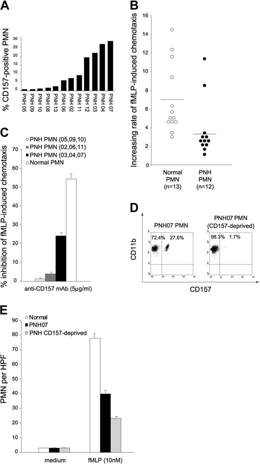 Figure 6. Chemotactic response to fMLP of neutrophils from patients with PNH. (A) PMNs isolated from the peripheral blood of 12 patients were evaluated for the expression of CD157 using RF3-FITC mAb. Cytofluorimetric analysis was performed on at least 10 000 cells. The results are expressed as percentage of CD157+ PMNs. (B) Summary of the results of migration of neutrophil from 12 patients with PNH (•)in response to 10 nM fMLP analyzed in parallel with 13 healthy donors (○). The increasing rate of fMLP-induced chemotaxis was evaluated as fMLP-induced migration/basal migration. P = .001. (C) Inhibitory effect of anti-CD157 mAb on neutrophil chemotaxis. The results are the average of 13 healthy donors analyzed and of 3 patients with PNH with a virtually absent (05, 09, 10), low (< 15%) (02, 06, 11), or significant (> 20%) (03, 04, 07) percentage of PMNs expressing CD157. Results are expressed as percentage of inhibition of fMLP-induced chemotaxis following CD157 ligation. (D) PMNs from the PNH07 patient with -30% normal neutrophils were enriched in GPI- PMNs, by negative selection with anti-CD157–coated magnetic beads. (E) The impaired migration of neutrophils from the PNH07 patient (▪) is increased in the CD157-deprived population (▦). There were 5 fields counted per well, and neutrophil chemotactic response was expressed as the mean number of migrated cells per high power field from triplicate wells ± SD. *P < .05.