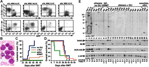 Figure 6. GvL against Bcr-Abl–induced B-lymphoblastic leukemia. (A) Flow cytometric analysis of chimerism (top row) and B-lymphoblastic leukemia (bottom row) in serial peripheral blood samples from a representative mouse with mixed chimerism and Bcr-Abl–induced B-ALL. Circulating leukemic cells were detected with antibody against the B-cell differentiation antigen BP-1/6C3.26 Blood sampling and analysis were performed on days 13, 16, 19, and 24 after BMT, and DLI was administered on days 14, 17, and 20 with a total of 1.1 × 108 allogeneic splenocytes. Note the disappearance of GFP+ cells by day 24, accompanied by conversion to full allogeneic chimerism. (B) Wright-Giemsa stain of day-16 peripheral blood from panel A, demonstrating circulating immature mononuclear blasts (magnification, 500 ×). (C-D) Cumulative leukemic mortality (C) and overall survival (D) for recipients of TCD p210 BCR-ABL–transduced BM from non–5-FU-treated Balb/c donors and TCD B6 BM, either without DLI treatment (blue, n = 4), with administration of allogeneic splenocytes at the time of BMT (green, n = 4), or with early DLI treatment of established mixed chimeras with B-ALL (yellow, n = 20). The frequency of fatal B-ALL in the DLI-treated group was significantly lower than in untreated chimeras (P = .007, Fisher exact test). Two mice in the cohort that received splenocytes at BMT died because of engraftment failure on day 7 and 8 after transplantation (see the second paragraph on this page). (E) Genomic DNA from the indicated tissues (PE indicates pleural effusion) was analyzed by Southern blot as in Figure 2G. Lanes 4 to 7 are DNAs from leukemic chimeric mice with B-ALL that did not receive DLI; note near single-copy levels of BCR-ABL provirus in lanes 5 and 6. Lanes 8 and 9 are the spleen DNAs from 2 different mice that received splenocytes at the time of BMT. No GFP+ clones or BCR-ABL provirus are detectable, and the spleen is composed mostly of cells of B6 origin. Lanes 10 to 24 represent DNAs from chimeric mice with B-ALL treated with DLI. Lanes 10 to 11 and 25 to 26 are from 2 mice that failed DLI because of poor or absent chimerism. Brackets indicate samples from the same individual mice.