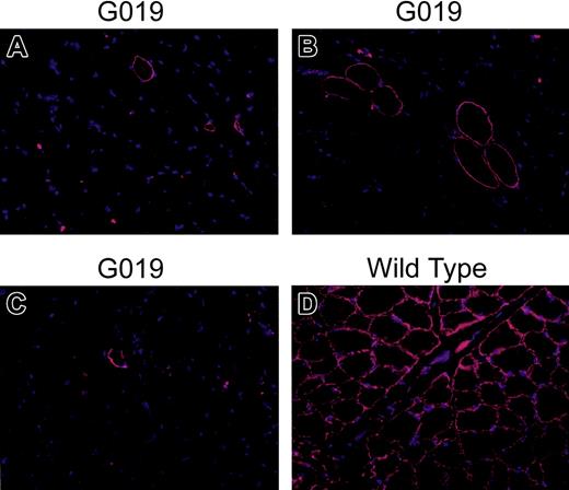 Figure 5. Dystrophin-positive fibers before and after HCT and at autopsy. Immunofluorescence staining was performed on muscle tissue sections from pre- and posttransplantation biopsies; necropsy and wild-type dogs were used as positive controls. Sartorius from (A) before HCT and (B) bicep from necropsy; (C) diaphragm from necropsy; (D) sartorius muscle from wild-type dog. Normal mouse immunoglobulin G (IgG; Invitrogen) was used as negative control (not shown). Nonfixed sections were blocked in 3% bovine serum albumin in 1 × Dulbecco phosphate-buffered saline (PBS; Gibco) and incubated for 60 minutes at room temperature with mouse anti–human dystrophin monoclonal antibody (NCL-DYS2, 20 μg/mL; Novocastra Laboratories). Sections were then rinsed 3 times for 15 minutes in PBS and incubated in the dark for 30 minutes at room temperature with rabbit anti–mouse Rhodamine-conjugated secondary antibody (1:100 dilution; Invitrogen). Preparations were counterstained with 4′, 6-diamidino-2-phenylindole (DAPI; Sigma). Sections were then rinsed in PBS (3 × 15 minutes) and mounted in Vectashield (Vector Laboratories). Fields were chosen to show rare positive fibers. Original magnification × 20.