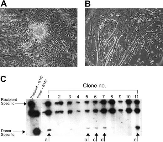 Figure 6. Clonal analyses of muscle-derived cells from HC transplant xmd recipients. Donor or recipient origin of the muscle-derived cell clones was determined by VNTR analyses. Fibroblast (A) or muscle clones (B) were isolated, harvested, and assayed by VNTR analyses (C). The arrows in panel C refer to the donor-specific bands in the satellite cell clones revealing a mixed genotype in 5 of the clones with donor contributions ranging from 2% to 35% (a = 10%, b ≤ 5%, c ≤ 5%, d ≤ 5%, and e = 20%). Original magnification × 40 (A,B).
