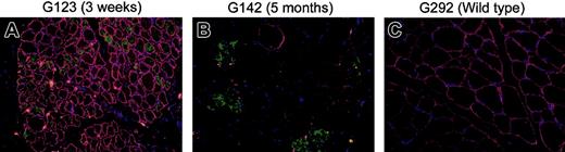 Figure 7. Dystrophin and fetal myosin staining in muscle fiber transplants in xmd hematopoietic chimeras at 3 weeks and 5 months after transplantation of muscle. Myofiber transplant from original HC donors to the xmd HC transplant recipients was performed on 3 pairs of dogs. Muscle biopsies were taken at 3 weeks (G123) and 5 months (G141 and G142) after transplantation and costained with dystrophin (red), fetal myosin (green, indicating regeneration), and DAPI (blue, showing nuclear staining). Immunofluorescence staining was performed as described in Figure 5, with the following primary antibodies: rabbit anti–mouse dystrophin (1:400, a kind gift from Jeff Chamberlain, University of Washington, Seattle) and mouse anti–rat fetal myosin (1:20, NCL-MHCd; Novocastra Laboratories). Donkey anti–rabbit Rhodamine-conjugated secondary antibody and rabbit anti–mouse FITC-conjugated secondary antibody (1:100 dilution; Invitrogen) were used for detection. Normal mouse and rabbit isotype (Invitrogen) antibodies were used as negative controls. Focal areas of brightly stained dystrophin-positive fibers were noted in panel A and were also positive for fetal myosin staining. Scattered staining for dystrophin and fetal myosin was observed in panel B after 5 months. However, dystrophin-positive fibers were now negative for fetal myosin. Wild-type muscle from G292 was used as control.