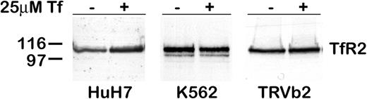Figure 2. TfR2 increases in HuH7 cells, but not in K562 or TRVb2 cells. Cells were cultured for 24 hours after the addition of 25 μM diferric Tf to the medium. The level of TfR2 in lysates from HuH7 (50 μg), K562 (20 μg), and TRVb2 (10 μg) cells was determined by Western blot with chemiluminescence detection. In cells endogenously expressing TfR2, treatment with diferric Tf increased TfR2 in HuH7 human hepatoma cells but not in K562 erythroleukemia cells. TRVb cells stably transfected with TfR2 (TRVb2) did not respond to diferric Tf.