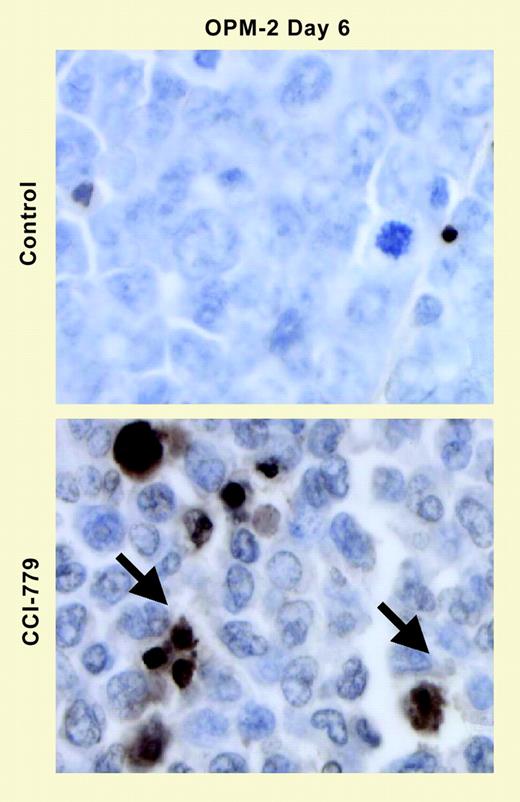 CCI-779 induces myeloma cell apoptosis. See the complete figure in the article beginning on page 4181.