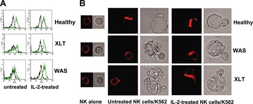 Figure 2. IL-2 restores the ability of WAS and XLT NK cells to accumulate F-actin upon their interaction with sensitive targets. (A) Representative example of FACS analysis. F-actin fluorescence intensity in NK cell binders at time 0 (black line) and 30 minutes (green line). (B) Representative example of confocal microscopy analysis showing F-actin redistribution at the contact area of normal, XLT, and WAS NK cells and sensitive targets. NK cells from 4 healthy donors, 4 XLT patients, and 3 WAS patients, treated or not treated with human recombinant IL-2, were allowed to bind to K562 target cells for 15 minutes at 37°C and then were fixed and stained with rhodamine phalloidin. PBS was used as the imaging solution. Phalloidin staining of conjugates and the corresponding bright-field images are shown (original magnification, × 600). Of 100 conjugates analyzed, F-actin accumulation at the contact area was found in 76.5% ± 1.5% of normal NK cell binders, 30.7% ± 4.3% of XLT-NK cell binders (P < .001), and 25% ± 2.1% of WAS NK cell binders (P < .001). Treatment with IL-2 did not change F-actin accumulation in normal NK cell binders (81% ± 2%), whereas it significantly enhanced F-actin accumulation in XLT and WAS NK cell binders 64% ± 5% and 50% ± 4%, respectively (P < .002). P values were calculated comparing the mean percentage of F-actin redistribution in NK cell-target cell conjugates from patients with XLT and WAS with that of control donors or with that of IL-2-treated XLT and WAS NK cells using the Student t test.