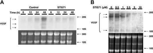Figure 4. mRNA expression in K 562 cells treated by imatinib mesylate (STI571) in vitro. K562 cells (100 000 cells/mL) were maintained in 10% serum containing medium for 48 hours in the absence (control) or in the presence of the indicated imatinib concentrations. Total RNA (10 μg) isolated for the indicated periods of time were analyzed by Northern blotting. Ribosomal RNAs are shown as a loading control. A representative of 3 independent experiments is shown. (A) Time course of VEGF mRNA concentrations in K562 cells treated with or without 2.5 μM imatinib. (B) VEGF mRNA in K562 cells treated with different concentrations of imatinib for 48 hours.