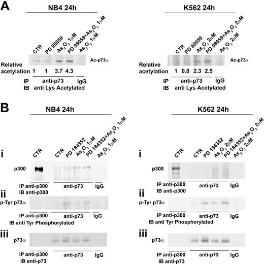 Figure 2. Apoptotic doses of ATO induce TAp73α acetylation and MEK1 inhibition promotes TAp73α tyrosine phosphorylation in leukemic cells. (A) Leukemic cells were pretreated with either DMSO or PD98059 (40 μM) for 3 hours and then treated with ATO (1 μM, NB4; or 2 μM, K562) for 24 hours. Lysates from treated cells were subsequently immunoprecipitated with a rabbit polyclonal anti-p73 (H79; Santa Cruz Biotechnology) or with a control antibody from lysates of NB4 and K562 treated with ATO. The immunoprecipitates were analyzed by sodium dodecyl sulfate-polyacrylamide gel electrophoresis (SDS-PAGE) and immunoblotted using a rabbit polyclonal antiacetylated lysine (Upstate Biotechnology, Lake Placid, NY). To evaluate the relative levels of p73 acetylation, bands were subjected to densitometric scanning using TINA 2 software (Raytest Isotopenmessgerate, Staubenhardt, Germany). (B) Leukemic cells were pretreated with either DMSO or PD184352 (1 μM) for 3 hours and then treated with ATO for 2 hours (1 μM; NB4) or for 24 hours (2 μM; K562). Extracts from mock and treated NB4 and K562 cells were immunoprecipitated with a rabbit polyclonal anti-p300 (N-15; Santa Cruz Biotechnology) or a rabbit polyclonal anti-p73 (H79; Santa Cruz Biotechnology) or with a control antibody. The immunoprecipitates were analyzed by SDS-PAGE and immunoblotted using rabbit polyclonal anti-p300 antibodies (N-15; Santa Cruz Biotechnology; subpanel i), or a mouse monoclonal antiphosphotyrosine antibody (clone 4G10; Upstate Biotechnology; subpanel ii). A 1:5 aliquot of the immunoprecipitated material was immunoblotted with the anti-p73 monoclonal antibody (clone 1288; Imgenex, San Diego, CA; subpanel iii).