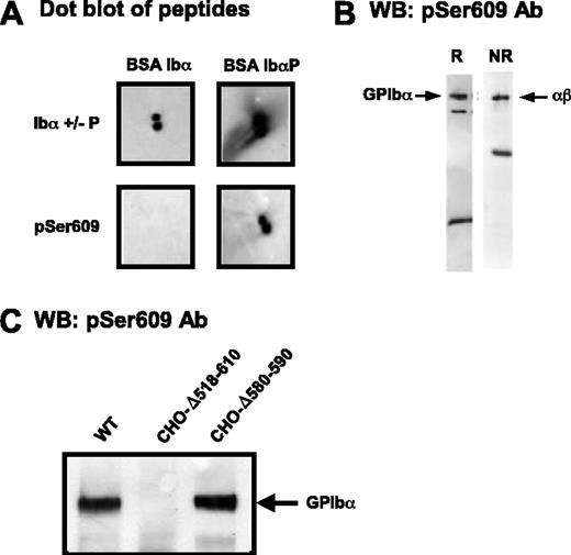 Figure 2. Deletion of the GPIbα 580-590 sequence does not interfere with Ser609 phosphorylation. (A) Dot blots of BSA-CYSGHSL or BSA-CYSGH(pS)L (peptides corresponding to the nonphosphorylated and phosphorylated C-terminus of GPIbα) with IgG against either the phosphorylation-independent (anti-Ibα+/-P) or phosphorylated (pSer609) C-terminal peptide of GPIbα. Blots were visualized using standard ECL substrates. (B) Western blots (WB) of whole platelet lysates analyzed by SDS-PAGE under reducing (R) or nonreducing (NR) conditions and probed with anti-pS609 (pSer609). The major band at 135 kDa corresponds to GPIbα (disulfide-linked to GPIbβ, nonreduced); the band at approximately 20 kDa reduced or approximately 50 kDa nonreduced represents the membrane-associated calpain digestion fragment of GPIbα (minus the soluble extracellular glycocalicin fragment), which is linked to GPIbβ when nonreduced. (C) Triton X-100 lysates of GPIb-IX CHO cells were separated by 4% to 15% SDS-PAGE and immunoblotted with the pSer609 polyclonal antibody. Phosphorylated GPIbα was detected in cells expressing the wild-type complex or a complex containing the Δ580-590 deletion but not in cells lacking the entire GPIbα intracellular domain.