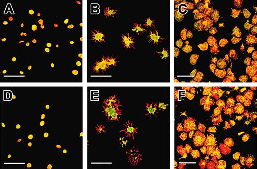 Figure 5. The GPIbα intracellular domain is dephosphorylated after platelet adhesion and shape change on a VWF matrix. Resting platelets were either fixed and allowed to adhere to a polylysine matrix (A,D), or allowed to adhere to a VWF matrix in the presence (B,E) or absence (C,F) of EDTAby incubation with the matrix for 20 minutes in the presence of botrocetin followed by washing and fixation. GPIbα was labeled with ALMA.12-Cy3 (red), and phosphorylated GPIbα was labeled with pSGPIb1 (A-C) or pSer609 (D-F), which was revealed with a secondary FITC-coupled antibody (green). Samples were analyzed by dual-label confocal microscopy. (A,D) Discoid platelets appeared predominantly yellow after staining with either pSGPIb1 or pSer609, indicating that GPIbα was mainly phosphorylated in resting platelets. (B,E) When platelets adhered to a VWF matrix and integrin activation was blocked with EDTA and ReoPro, they extended numerous filopodia. The staining of the cell body remained yellow, whereas the filopodia appeared in red, suggesting a lack of recognition by pSer609 or pSGPIb1 and dephosphorylation of pSer609 and pSer587/590 within the membrane extensions. (C,F) In the absence of ReoPro and EDTA, platelets spread on the VWF matrix and the labeling appeared as a mixture of yellow and red over the entire cell surface, pointing to the existence of separate pools of phosphorylated and dephosphorylated GPIbα. Shown is 1 representative experiment of 3 performed. Scale bars indicate 10 μm.