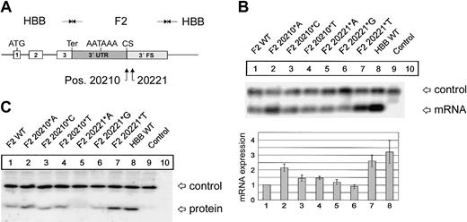 Figure 1. F2 mutations at positions 20210 and 20221 cause an increased abundance of F2 mRNA and protein. (A) In the hybrid genes, the 3′UTR including the poly(A) signal (AATAAA), the CS, the U-rich region, and 62 nt's of the 3′FS of the HBB gene were replaced by the respective sequences of F2 with either the normal F2 WT or the F2 20210*A, F2 20210*C, or F2 20210*T mutations at the CS (pos. 20210) or the F2 20221*A, F2 20221*G, or F2 20221*T mutations 11 nt's 3′ of the CS (pos. 20221). (B) Northern blot with an HBB-specific cRNA probe of cytoplasmic RNA preparations from cells cotransfected with the indicated hybrid constructs and the WT+300 E3 control. The RNA loaded in the control lanes 9 and 10 originate from cells that were either transfected with the WT+300 E3 control plasmid only or were not transfected. The bar diagram shows the fold difference relative to the F2 WT mRNA expression levels ± SD after normalization for transfection efficiency. Bars 1 to 8 represent quantification of lanes 1 to 8. (C) Immunoblot of protein lysates from cells transfected with constructs as shown in panel B. The blot was probed with an HBB-specific antibody.