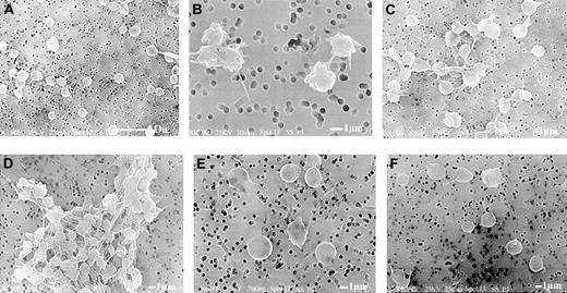 Figure 8. Scanning electron micrographs reveal that HOCl-LDL alone induces formation of microaggregates; combination with ADP results in stable aggregate formation. Washed platelets were subjected to HOCl-LDL (20 μg/mL), ADP (1 μM), and the combination of the 2 agonists with or without the presence of PKC inhibitor for 30 seconds at 37°C as described for Figure 1 and then fixed with glutaraldehyde for subsequent processing and examination by scanning electron microscopy. (A) Control platelets, (B) ADP alone, (C) HOCl-LDL alone, (D) HOCl-LDL + ADP, (E) HOCl-LDL + bisindolylmaleimide (3 μg/mL), (F) HOCl-LDL + ADP + bisindolylmaleimide. The white bar represents 10 μm for panel A and 1 μm for panels B-F.