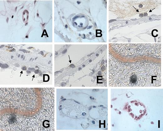 Figure 3. Representative photomicrographs of rat mesenteric arterioles and venules in animals untreated and treated with Ang II. Arteriolar endothelium after 4-hour saline (A) or Ang II (B) exposure. CD3+ staining of leukocytes adhered to the arteriolar endothelium after 4-hour Ang II exposure (C). ED1-positive staining of leukocytes adhered to the arteriolar endothelium after 4-hour Ang II exposure (D). ED1-positive staining of a leukocyte emigrating through the arteriolar endothelium after 4-hour Ang II exposure (E). Video photomicrographs of the rat mesenteric arterioles after 24-hour buffer intraperitoneal injection (F). Video photomicrographs of the rat mesenteric arterioles after 24-hour Ang II intraperitoneal injection (G). Venular endothelium after 4-hour saline (H) or Ang II exposure (I). A 100×/1.25 oil objective lens was used for panels A-E and H-I; a 20×/0.40 objective lens was used for panels F-G. Panels A, B, H, and I were stained with hematoxylin/eosin, and panels C, D, and E were lightly counterstained with hematoxylin. Leica IM1000 software capture imaging (Leica Microsystems, Wetzlar, Germany) was used to obtain the images in panels A-E and H-I, and a Sony color video printer was used for the images in panels F and G.