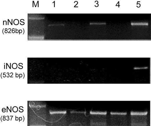 Figure 1. Expression of NOS isoforms in human mast cell populations. nNOS: RT-PCR analysis of nNOS mRNA in HMC-1 (lane 1), KU812 (lane 2), skin MCs (lane 3), and LAD 2 cells (lane 4). Human brain RNA was used as a positive control (lane 5). iNOS: RT-PCR analysis of iNOS mRNA in HMC-1 (lane 1), KU812 (lane 2), skin MCs (lane 3), and LAD 2 cells (lane 4). Human brain RNA was used as a positive control (lane 5). eNOS: RT-PCR analysis of eNOS mRNA in HMC-1 (lane 1), KU812 (lane 2), skin MCs (lane 3), and LAD 2 cells (lane 4). Human endothelial cell RNA was used as a positive control (lane 5). The sizes of expected amplified products are indicated. Molecular weight markers (M) are indicated. Results are representative of at least 3 independent RNA isolations.