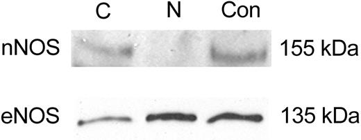 Figure 3. Immunoblot analysis of NOS protein expression in subcellular fractions from HMC-1 cells. HMC-1 cells were lysed and separated into cytosolic (Cy) or nuclear (N) fractions as described in “Materials and methods”; proteins from each fraction were separated by SDS-PAGE under reducing conditions. Control (Con) proteins (human brain and endothelial cell lysate, respectively) were run concurrently. Representative immunoblot of nNOS and eNOS content in subcellular fractions. For all blots, equal amounts of protein (15 μg) were loaded. Molecular weight markers indicated at right. All blots are representative of at least 3 independent experiments.