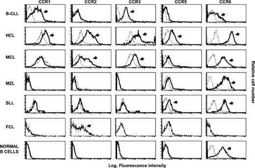 Figure 1. Flow cytometry analysis of CCR shows a distinct pattern of expression of these receptors among different B-NHLs. The histograms were obtained from a representative healthy subject and from malignant B lymphocytes recovered from representative patients with different types of NHL. The analysis was performed by flow cytometry on purified B lymphocytes following incubation with anti-CCR receptor mAb (bold histograms) and control isotype mAb (dotted histograms). Arrows denote positive cases on the basis of the Kolmogorov-Smirnov test.