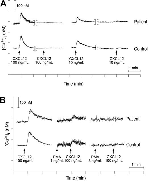 Figure 4. Calcium transients in activated T cells from WHIM patients. Fura-2-loaded lymphocytes of WHIM patient P3 or healthy subject stimulated with CXCL12 at 100 ng/mL. The calcium concentration (y-axis) obtained following normalization of fluorescence ratio as described in “Patients, materials, and methods” is plotted against time (x-axis). (A) Homologous desensitization of lymphocytes to CXCL12 was investigated by analysis of calcium transients in response to CXCL12 at 100 ng/mL or 10 ng/mL in cells previously exposed to the same concentration of the chemoattractant. (B) Lymphocyte desensitization in response to PMA was analyzed in patients and healthy subjects by stimulation of cell suspension with PMA at 1 ng/mL or 3 ng/mL following addition of CXCL12, as indicated in the figure.
