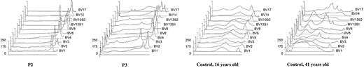 Figure 7. Oligoclonal TCRBV repertoire in WHIM patients. TCRBV diversity profiles of the indicated TCRBV segments obtained after heteroduplex analysis of TCRBV-specific PCR products prepared from lymphocytes from patients P2 and P3 and from 2 age-matched control subjects. Subsequent analysis with the GelWorks 1D software was performed. The threshold is indicated with dotted lines.