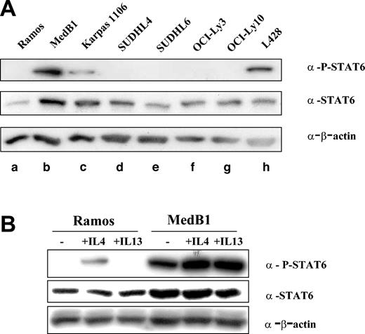 Figure 2. STAT6 phosphorylation in PMBL-derived cell lines. (A) Cell lysates were prepared from one Burkitt lymphoma-derived cell line (a: Ramos), 2 PMBL-derived cell lines (b: MedB1 and c: Karpas 1106), 4 DLBCL-derived cell lines (d: SUDHL4, e: SUDHL6, f: OCI-Ly3, and g: OCI-Ly10), and 1 Hodgkin-derived cell line (h: L428). Equal amounts of whole cell lysate were subjected to SDS-PAGE followed by Western blot analysis. Phosphorylated STAT6 was identified using phosphospecific antibody for Tyr641 phosphorylated STAT6. Blots were stripped and reprobed with an anti-STAT6 antibody. As a loading control, blots were probed with anti-β-actin antibody. (B) Ramos and MedB1 cells were treated for 10 minutes with 10 ng/mL IL-4 or 5 ng/mL IL-13, or left untreated (-) and samples prepared and analyzed as in panel A.
