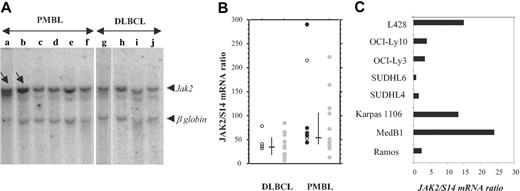 Figure 5. JAK2 gene amplification and overexpression in PMBL. (A) Southern analysis of genomic DNA extracted from 6 PMBL (a-d) and 4 DLBCL (g-j) samples, digested with EcoRI, and hybridized simultaneously with a JAK2 and a β-globin probe. The radioactivity bound to the 10-kb JAK2 genomic fragment and to the 5.5-kb β-globin genomic fragment was quantified with a phosphorimager. JAK2/β-globin ratio was 1.8 ± 0.2 in samples c to j, 8 in sample a (arrow), and 3 in sample b (arrow). (B) Quantitative RT-PCR analysis of JAK2 expression in 22 PMBL samples and 20 DLBCL samples. JAK2 mRNA levels, expressed as JAK2 mRNA copy number per 100 copies of S14 mRNA, were determined on frozen-tumor samples with no available formalin-fixed sections (), and in P-STAT6-positive (•) or P-STAT6-negative (○) tumors. Bars indicate median and interquartile values. (C) Quantitative RT-PCR analysis of JAK2 expression, performed as in panel B, in 2 PMBL-derived cell lines (MedB1 and Karpas 1106) compared with 4 DLBCL-derived cell lines (SUDHL4, SUDHL6, OCI-Ly3, and OCI-Ly10), 1 Burkitt-derived cell line (Ramos), and 1 Hodgkin-derived cell line (L428).