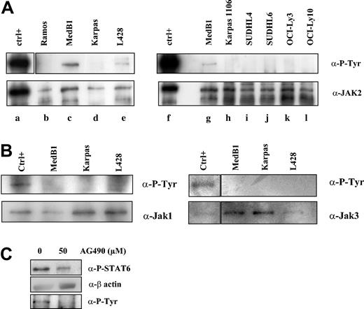 Figure 6. Constitutive JAK2 activation in PMBL-derived MedB1 cells. (A) Whole-cell extracts from control (ctrl; TPO activated UT7-mpl, lanes a, f), 1 Burkitt-derived cell line (Ramos, lane b), 2 PMBL-derived cell lines (MedB1, lanes c, g; Karpas 1106, lanes d, h), 2 GC-DLBCL cell lines (SUDHL4, lane i; SUDHL6, lane j), and 2 ABC-DLBCL cell lines (OCI-Ly3, lane k; OCI-Ly10, lane l) were prepared and immunoprecipitated with anti-JAK2 antibodies. Immunoprecipitates were analyzed by Western blot using anti-P-Tyr or anti-JAK2 antibodies. (B) Whole-cell extracts from control (IL-4-treated MedB1 cells) and indicated cell lines were immunoprecipitated with anti-JAK1 or anti-JAK3 antibodies and were analyzed by Western blot using anti-P-Tyr or anti-JAK1 or JAK3 antibodies, as shown in the figure. (C) MedB1 cells were treated with DMSO or 50 μM AG490 for 24 hours. Whole cell extracts were analyzed by Western blot using anti-P-STAT6 or anti-β-actin antibodies as indicated on the right of the figure. The lower panel shows Western blot analysis of JAK2 immunoprecipitates with an anti-P-Tyr antibody.