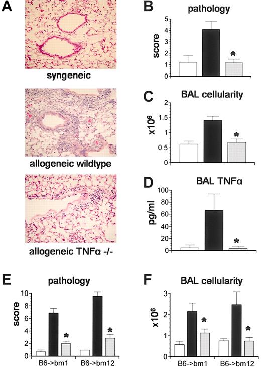 Figure 2. TNF-α production by donor cells is critical to the development of IPS.Lethally irradiated B6D2F1 mice received BMT from either syngeneic (B6D2F1, □), allogeneic wild-type (B6129SF2/J, ▪), or allogeneic TNF-α-/- (B6.129S6-TnftmGk1, ▦) donors as described in “Materials and methods.” Animals were analyzed at week 5 for (A-B) lung histopathology (hematoxylin and eosin; magnification × 200), (C) BAL fluid cellularity, and (D) BAL fluid TNF-α levels. Data are presented as mean ± SEM and are from 1 of 2 comparable experiments; n = 5 to 9 per group; *P < .05. In a second set of experiments, bm1 or bm12 mice received BMT from either syngeneic (bm1 or bm12, □), allogeneic wild-type (B6129SF2/J, ▪), or allogeneic TNF-α-/- (B6.129S6-TnftmGk1, ▦) donors as described in “Materials and methods.” (E) Lung histopathology and (F) BAL fluid cellularity were decreased after TNF-α-/- BMT in both systems. Data are presented as mean ± SEM and are from 1 of 2 comparable experiments; n = 4 to 7 per group; *P < .05, ▦ versus ▪.