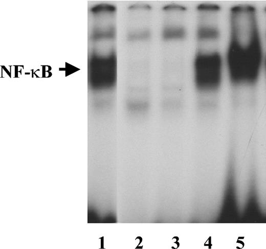 Figure 6. NF-κB activation by free or fibrinogen-bound IL-1β Endothelial cells were plated on gelatin-coated wells in McCoy 5A medium supplemented with 20% FBS, 50 μg/mL endothelial cell growth supplement (ECGS), and 100 μg/mL heparin and grown to confluence. The cells were then washed twice with McCoy medium and incubated with 2 ng/mL of IL-1β in the presence or absence of 1 μg/mL fibrinogen for 2 hours. Nuclear protein extracts were then prepared, and EMSA was performed using a double-stranded 32P-labeled consensus NF-κB primer. LPS (1 μg/mL) was used as a positive control. Lanes are as follows: 1, LPS; 2, medium alone; 3, fibrinogen; 4, IL-1β; and 5, fibrinogen plus IL-1β.