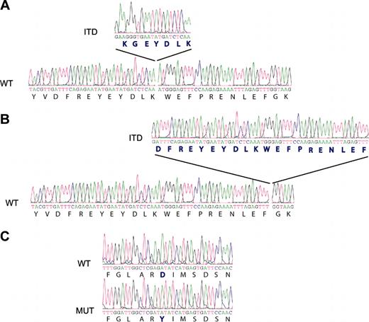 Figure 1. FLT3 tyrosine kinase activating mutations in CD117/KIT+ T-ALL samples. RT-PCR analysis of the juxtamembrane region suggested length mutations (ITDs) in cases 1 (A) and 2 (B). Sequence analysis of PCR products demonstrated the insertion of 21 (case 1) and 60 (case 2) base pairs in positions 1863 and 1894 of the juxtamembrane region of the FLT3 kinase gene, respectively. In case 3, the D835Y mutation (MUT) in the activation loop of FLT3 was detected when compared with the wild-type (WT) allele. (C) Mutation position annotation is based in the FLT3 reference sequence NM_004119.