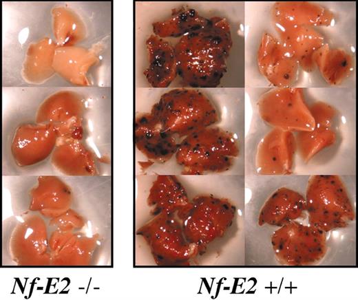 Figure 3. Pulmonary metastasis in platelet-deficient mice. Example of tumor burden in right lobes of lungs from Nf-E2-/- mice and wild-type littermates from a single experiment. Note the almost complete absence of surface tumors in lungs from platelet-deficient (Nf-E2-/-) animals.