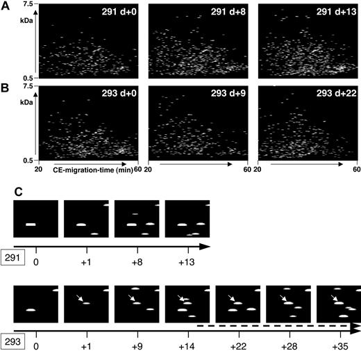 Figure 4. Polypeptide plots from patient no. 291 (no complications) and patient no. 293 (GVHD). Polypeptide plots (polypeptide mass over CE migration time) are shown for 2 patients, no. 291 (A) and no. 294 (B), at an early posttransplantation period. While patient 291 had no complications in the observation period, patient 294 was diagnosed with GVHD on day +14. To visualize the search for biomarkers and to show the differences between these patients, panel C shows a magnified view of the plots obtained at different days after HSCT (0 to +13/+35 as shown by the black arrow) of the polypeptide 1.85 kDa/34 minutes. This polypeptide appears in the samples of patient 293, as early as day +1, showing increasing intensity over the progression of GVHD (arrow, starting at day +15, indicating the clinical diagnosis of GVHD).