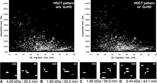 Figure 5. Compiled plots of patients with and without GVHD. The data obtained on the samples collected over the observation period were compiled for the patients without complications after HSCT (w/o GVHD) and compared with the polypeptide patterns obtained from patients at diagnosis of GVHD (w/GVHD). Comparison of the 2 patterns shows a number of differentially excreted polypeptides, as visualized here by inserts that magnify the particular parts of the pattern were the changes occur (marked by arrows). Shown are 4 discriminatory peptides, marked in each pattern with A to D and arrows indicating the position of each of these molecules in the compiled patterns, for patients without (w/o) or with (w/) GVHD. Panels A and C show polypeptides newly appearing in all patients with GVHD. Panel B shows a more than 10-fold increase in signal intensity observed in all samples of patients with GVHD, while panel D shows a more than 10-fold reduction of the intensity of the 3.44 kDa/44.1 minutes peptide.
