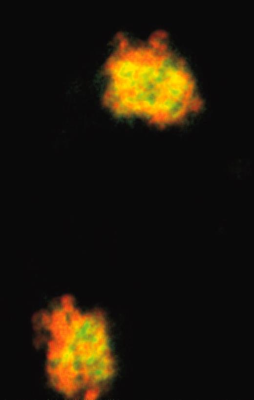 Interaction of IAC-1 to platelets deposited on collagen under flow. See the complete figure in the article beginning on page 390.