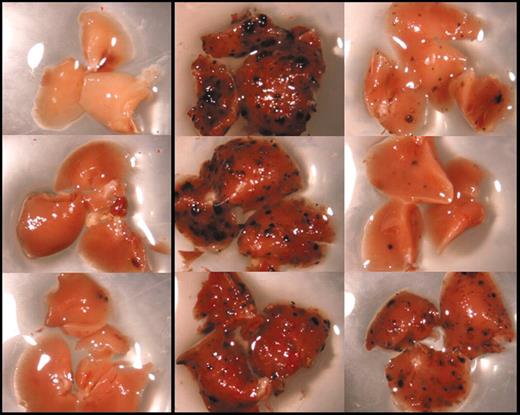 Pulmonary metastases in platelet-deficient mice. See the complete figure in the article beginning on page 397.