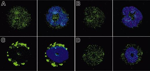 Figure 2. CD63+ granule translocation is inhibited in Rac2-/- neutrophils. Cytospins were prepared from freshly isolated BMNs treated with CB/fMLP (5 μM) for 15 minutes, stained with 10 μg/mL anti-CD63 as a primary granule marker (green), and counterstained with DAPI (blue) to show nuclear structure. Panels show representative images from (A) resting WT BMNs, (B) resting Rac2-/- BMNs, (C) CB/fMLP-stimulated WT BMNs, and (D) CB/fMLP-stimulated Rac2-/- BMNs, with the left panel in each case showing CD63 alone and the right panel showing combined images of CD63 immunoreactivity and DAPI nuclear stain. Original magnification, ×40.