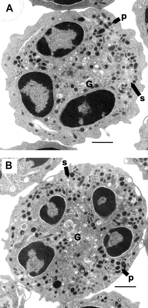 Figure 4. Normal granular morphology in neutrophils from rac2-/- mice. Neutrophils were pelleted from bone marrow and sectioned for EM analysis. Panels show typical cells from (A) WT and (B) rac2-/- mice. Labels indicate primary granule (p), secondary granule (s), and Golgi apparatus (G). The bar indicates 1 μm. Original magnification, ×7000.