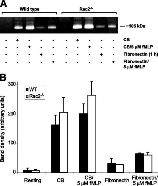 Figure 7. Release of tertiary granule MMP-9 is similar in WT and Rac2-/- neutrophils. (A) Supernatants of WT and Rac2-/- BMNs, either resting or stimulated with CB, CB with 5 μM fMLP, fibronectin (1 hour), or fibronectin (1 hour) with 5 μM fMLP, were separated by gel electrophoresis and analyzed by zymography to detect gelatinase activity, most of which migrated at approximately 105 kDa. (B) Graph showing the average optical density of MMP-9 activity in supernatants of cells stimulated by CB, CB with 5 μM fMLP, fibronectin adhesion (1 hour), or fibronectin (1 hour) followed by 5 μM fMLP. Error bars indicate SEM.
