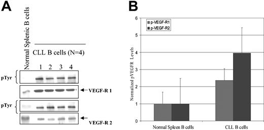 Figure 3. Normal splenic B and CLL B cells express differences in VEGF receptor autophosphorylation status. Protein and phosphorylation level of VEGF-R1 and VEGF-R2 in CLL B cells and splenic B cells are shown. (A) Isolated CLL B cells or spleen cells from a healthy donor were cultured in serum-free RPMI for 24 hours. Lysates (500 μg) were prepared and immunoprecipitated with either anti–VEGF-R1 or anti–VEGF-R2 antibody and then transferred to nitrocellulose. Blots were probed with phosphotyrosine antibody. Note the protein levels of VEGF-R1 and VEGF-R2 were approximately equivalent in both cell types, but the levels of spontaneous phosphorylation for VEGF-R1 and VEGF-R2 in spleen cells are much lower than in CLL B cells. (B) Densitometry was used to normalize the phosphorylated VEGF-R (p-VEGF-R) levels in the immunoblot and shows that the CLL B cells still retain a higher overall phosphorylation value for both VEGF-R1 and VEGF-R2 when compared with spleen cells.