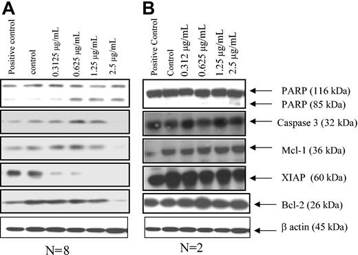 Figure 6. Effects of EGCG on Mcl-1 and XIAP proteins in CLL B cells. (A) Representative results for sensitive CLL B cells when EGCG is added to the majority of CLL B-cell cultures (n = 8 of 10). Thus, PARP cleavage decreases in Mcl-1, XIAP, and caspase-3, and little or no change in Bcl-2 is seen. Freshly isolated CLL B cells (n = 8 patients) were treated with either vehicle or EGCG for 24 hours. Protein extracts (50 μg) were prepared and subjected to SDS-PAGE, following transfer to nitrocellulose. The blot was probed with the antibodies of interest. (B) Representative blot for the EGCG-insensitive CLL B-cell populations. Note there was no change in the apoptotic proteins or PARP cleavage in the insensitive CLL patients.