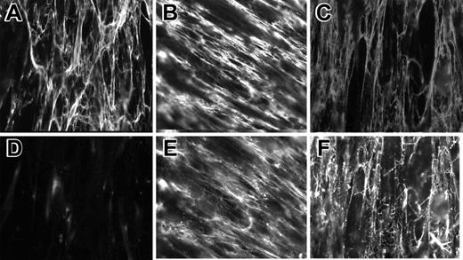 Figure 1. Immunofluorescent staining of Pg incorporated into the matrix produced by fibroblasts. WI38 fibroblasts were cultured in DMEM for 72 hours to produce ECM. Cells in selected wells were cultured with soluble plasma fibrinogen for an additional 2 hours, and the fibrin film formed on the surface of the cell layer was removed. Glu-Pg was added for 1 hour to wells with and without added fibrinogen. Cells were fixed and then incubated with mAb 8A11 against fibronectin (5 μg/mL), mAb 4-2 against fibrinogen (5 μg/mL), and polyclonal Ab against Pg (1:1000). Double immunostaining with anti-Fn (A) and anti-Pg (D). (B,E) Staining with anti-Fn and anti-Pg, respectively. (C,F) Staining with anti-Fg and anti-Pg, respectively.