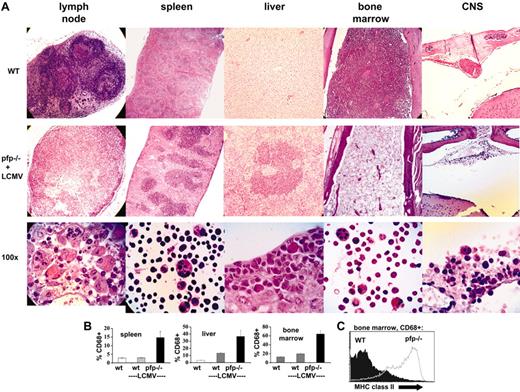 Figure 2. LCMV-infected pfp–/– mice display histopathologic features of HLH. (A) Tissue sections from uninfected wild-type mice or LCMV-infected pfp–/– mice were stained with hematoxylin and eosin. All images are of paraffin-embedded tissue, except the high-power views of spleen and bone marrow cells, which are cytospins. All pfp–/– samples were taken from mice 12 days after infection, except for the central nervous system (CNS) sections which were taken from mice infected 30 days previously and treated with anti-LCMV antibodies (Figure 6). (B) Tissues from wild-type mice (with and without LCMV infection) and LCMV-infected pfp–/– mice were analyzed by flow cytometry for the relative content of macrophage-lineage cells (% CD68+). Error bars represent SEM. (C) CD68+ cells from the bone marrow of wild-type and pfp–/– mice infected with LCMV 12 days previously were stained for MHC class II. Data (± standard error) are representative of at least 2 experiments with at least 3 mice in each group.