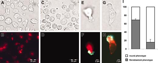 Figure 4. SDF has fibroblastoid morphology. The SDF (A-B) and the FDF (C-D) were separated according to their PKH26 staining after 1 week. Cells in the SDF are on average smaller; 69% of them revealed membrane protrusions. In contrast, cells in the FDF had a round morphology and only 16% displayed podia formation. CD133 (prominin) is more strongly expressed in the SDF and accumulates at the tip of lamellipodia (E-F; G-H; red = PKH26; green = CD133). Error bars represent SD. Cells were observed with a 40× immersion objective (40× HI; Olympus Optical, Hamburg, Germany), microscope model IX-70 (Olympus Optical) connected to a video camera (Colorview XS; Soft Images Systems, Münster, Germany; resolution: pixel size 6.7 × 6.7 μm; NA of 40 × objective: 1.0).