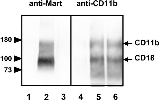 Figure 3. Immunoprecipitation analysis of allele-specific recombinant CD11b isoforms. Recombinant forms of CD11b/CD18 were produced in COS cells transfected with either the CD11b R61 isoform (Mart-positive; lanes 2 and 5) or the CD11b H61 isoform (Mart-negative; lanes 3 and 6). After cotransfection with CD18 construct, COS cells were surface labeled with biotin and then lysed. Nontransfected COS cells were used as negative control (lanes 1 and 4). Cell lysates were precipitated with anti-Mart or mAb LPM-19c against CD11b. Immunoprecipitates were analyzed on 7.5% sodium dodecyl sulfate–polyacrylamide gel electrophoresis (SDS-PAGE) under reduced conditions, blotted, and visualized using streptavidin-horseradish peroxidase and chemiluminescence substrate.