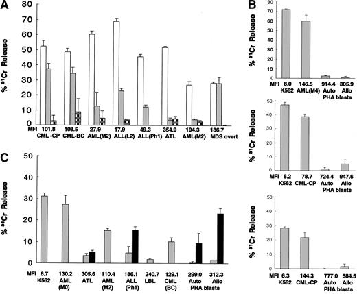 Figure 3. Cytolytic activities of CD94-expressing cells expanded from G-PBMCs against the patients' leukemic cells. (A) Cytolytic activities of HLA-matched donor CD94-expressing cells expanded from 8 different donor G-PBMCs against K562 cells (□), the patients' own leukemic cells (▦) , and autologous PHA blasts (). (B, C) Cytolytic activities of allogeneic third-party CD94-expressing cells expanded from 4 different donor G-PBMCs against K562 cells, the patients' primary leukemic cells, autologous PHA blasts, and allogeneic PHA blasts. Addition of anti–HLA class I mAbs (W6/32, 20μg/mL) (▪). MFIs of HLA class I on target cells are indicated. The data represented are the means ± SDs (effector-to-target ratio is 10:1).