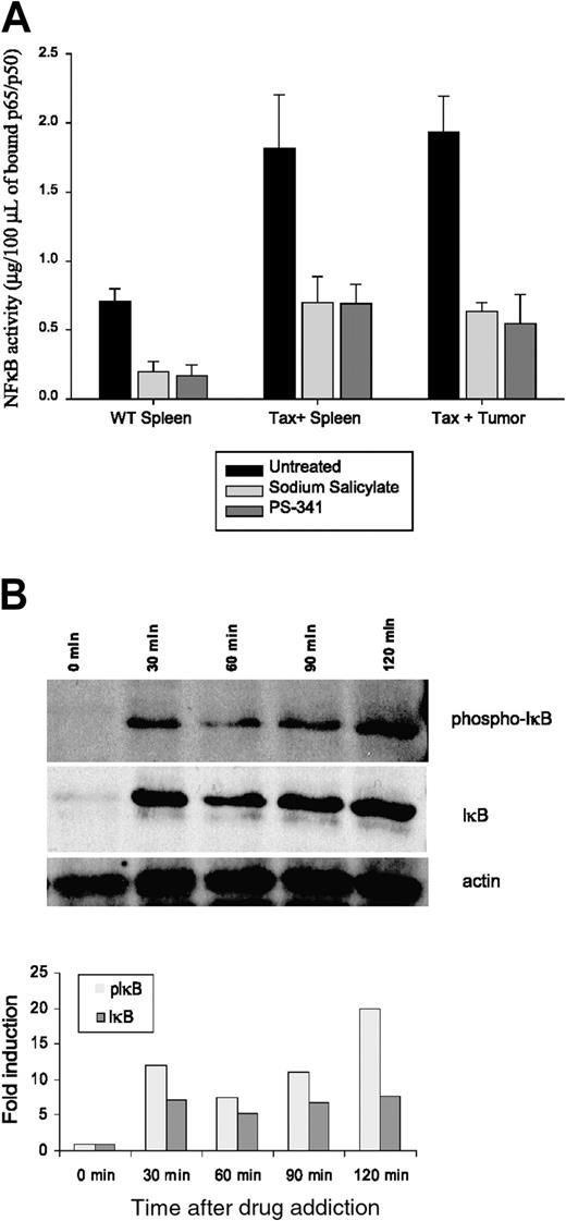 Figure 2. NF-κB activation is reduced in Tax transgenic mouse tumors treated with PS-341 in vitro. Nuclear extracts were prepared from Tax transgenic tissues, and representative results from 5 transgenic spleens and tumors and 5 nontransgenic splenocytes are shown. Tissues used included tumors arising on the nose, leg, or foot, as well as spleens with tumor involvement or nontransgenic splenocytes. (A) ELISA was performed as described in “Materials and methods.” Values are represented as means of 1 of 3 separate experiments. Error bars correspond to SEM between 5 animals in each group. The statistical significance of the inhibition was evaluated by a paired t test: P ≤ .05 for untreated compared to sodium salicylate treatments and P ≤ .05 for untreated compared to PS-341 treatments. (B) F8 cells were cultured with 10-7 M PS-341, harvested at 0, 30, 60, 90, and 120 minutes, washed, and lysed to prepare total cell extracts. For detection of phospho-IκB, IκB, and actin, cell lysates were subjected to electrophoresis on a 10% SDS-PAGE, transferred to nitrocellulose membrane, and immunoblotted with antiphospho-IκB, IκB, and actin (loading reference) antibodies. Blots were developed using a chemiluminescent substrate.