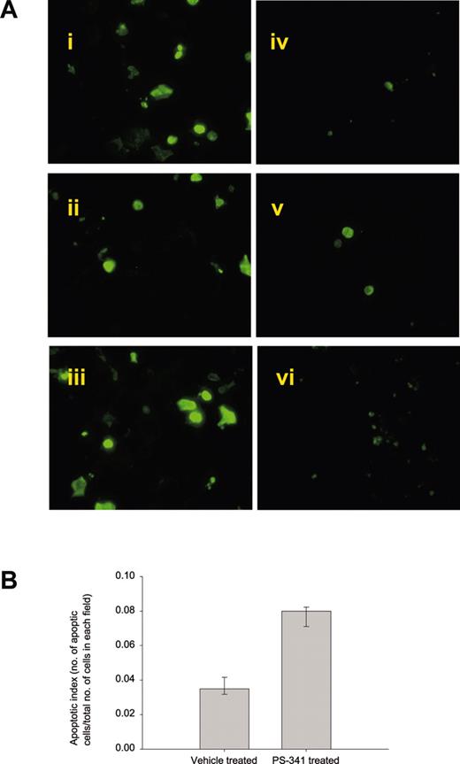 Figure 7. Effects of PS-341 on apoptosis in transplanted Tax tumors. (A) Control animals or animals treated with 0.1 mg/kg PS-341 (subcutaneously) or drug-treated mice with no tumor transplants were killed at 8 weeks of treatment. Apoptosis was measured on paraffin-embedded sections by TUNEL staining as described in “Materials and methods.” Levels of apoptosis were significantly higher in PS-341–treated tumors compared with controls. Analysis of DNA fragmentation is shown for 3 representative fields obtained from PS-341–treated tumors (i-iii) or vehicle-treated tumors (iv-vi). (B) The apoptotic index was calculated by dividing the number of TUNEL+ cells by the total number of cells in 6 random fields in 3 tumors. The statistical significance of apoptosis in response to PS-341 treatment was evaluated by a paired t test: P ≤ .002 for untreated compared to PS-341–treated tumors. Error bars correspond to SEM.